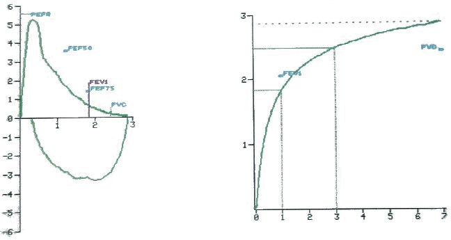 flowvolume1.gif